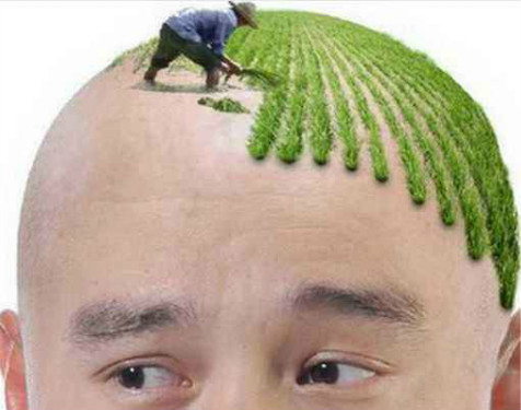 植发后几天毛囊稳固了