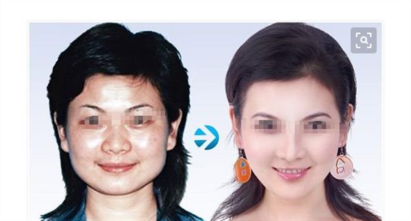 彩光<a href=http://www.mx185.com/listinfo-770-0.html target=_blank class=infotextkey>嫩肤</a>手术的优点有哪些呢