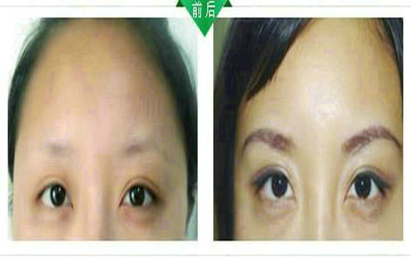 <a href=http://www.mx185.com/listinfo-655-0.html target=_blank class=infotextkey>切眉</a>多久可以<a href=http://www.mx185.com/listinfo-657-0.html target=_blank class=infotextkey>绣眉</a>?