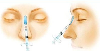 注射<a href=http://www.mx185.com/listinfo-737-0.html target=_blank class=infotextkey>隆鼻</a>整形术的价格