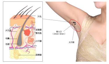有什么方法<a href=http://www.mx185.com/listinfo-766-0.html target=_blank class=infotextkey>去腋臭</a>
