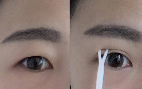 贴<a href=http://www.mx185.com/listinfo-724-0.html target=_blank class=infotextkey>双眼皮</a>贴眼皮松弛怎么办