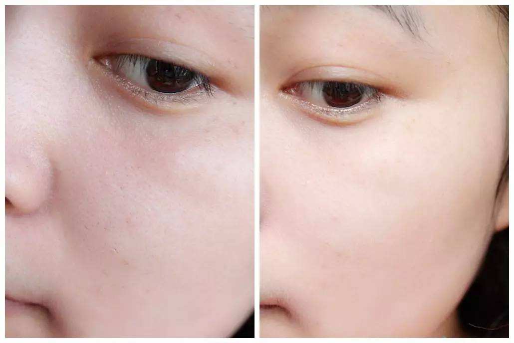 光子<a href=http://www.mx185.com/listinfo-770-0.html target=_blank class=infotextkey>嫩肤</a>和果酸的区别