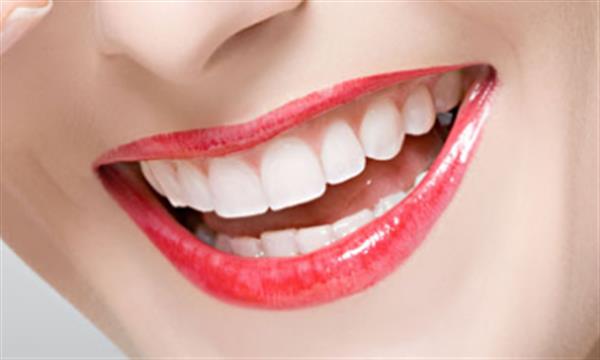 <a href=http://www.mx185.com/listinfo-825-0.html target=_blank class=infotextkey>牙齿种植</a>术前及术后护理