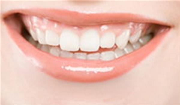 <a href=http://www.mx185.com/listinfo-825-0.html target=_blank class=infotextkey>牙齿种植</a>与假牙的区别