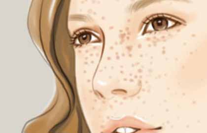 <a href=http://www.mx185.com/listinfo-774-0.html target=_blank class=infotextkey>去雀斑</a>大约需要多少钱