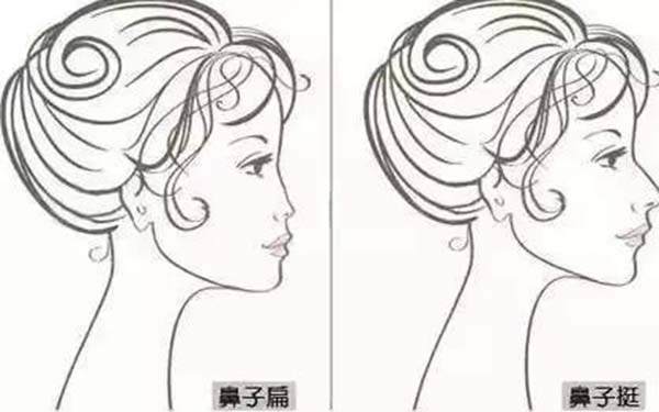 骆驼鼻手术方法