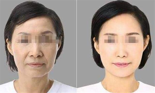 彩光<a href=http://www.mx185.com/listinfo-770-0.html target=_blank class=infotextkey>嫩肤</a>手术有哪些功效呢