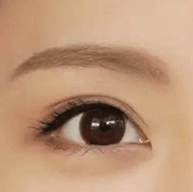 睫毛移植术效果持续时间