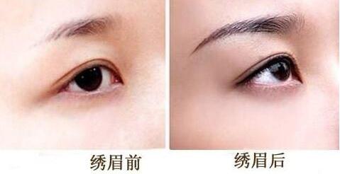眉部美容<a href=http://www.mx185.com/listinfo-657-0.html target=_blank class=infotextkey>绣眉</a>大概需要多少钱