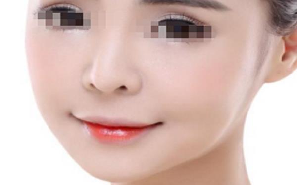 膨体多久取出较好?