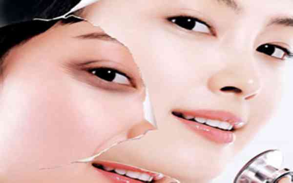 做脸部拉皮多少钱一次