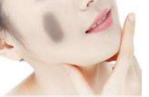 C6激光<a href=http://www.mx185.com/listinfo-773-0.html target=_blank class=infotextkey>去胎记</a>效果好吗
