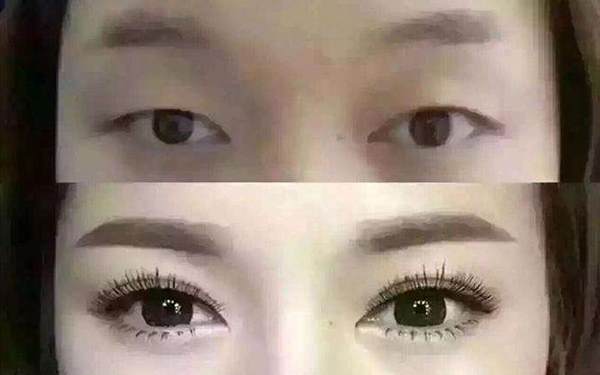 种眼睫毛前后对比图