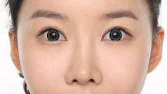 在广州做<a href=http://www.mx185.com/listinfo-704-0.html target=_blank class=infotextkey>眼部整形</a>手术多少钱