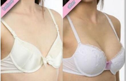 注射<a href=http://www.mx185.com/listinfo-618-0.html target=_blank class=infotextkey>隆胸</a>安全吗