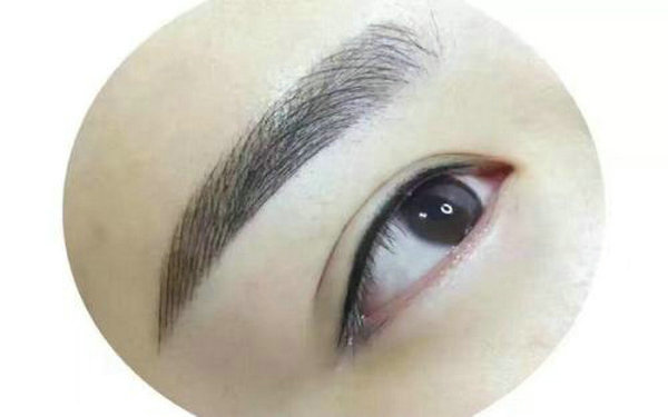 提眉术的缺点
