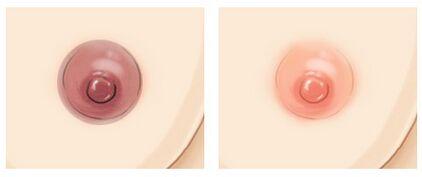 乳头<a href=http://www.mx185.com/listinfo-625-0.html target=_blank class=infotextkey>乳晕缩小</a>多少钱？