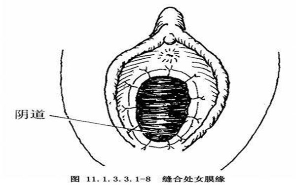<a href=http://www.mx185.com/listinfo-805-0.html target=_blank class=infotextkey>处女膜修复</a>的三种方法