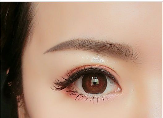 <a href=http://www.mx185.com/listinfo-655-0.html target=_blank class=infotextkey>切眉</a>手术后的图片