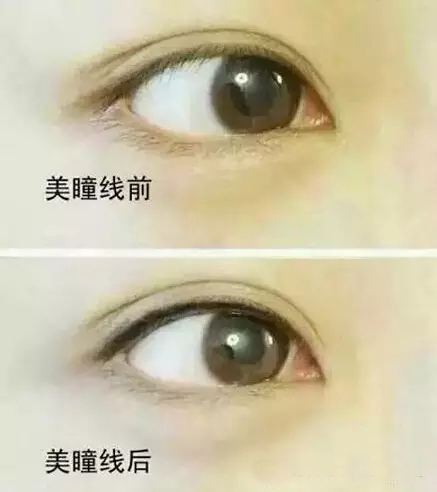 纹<a href=http://www.mx185.com/listinfo-705-0.html target=_blank class=infotextkey>美瞳线</a>几天能恢复