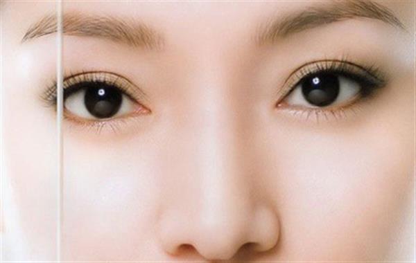 <a href=http://www.mx185.com/listinfo-724-0.html target=_blank class=infotextkey>双眼皮</a>整形要多少钱