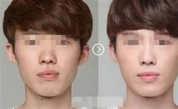 男人也可以做<a href=http://www.mx185.com/listinfo-737-0.html target=_blank class=infotextkey>隆鼻</a>手术