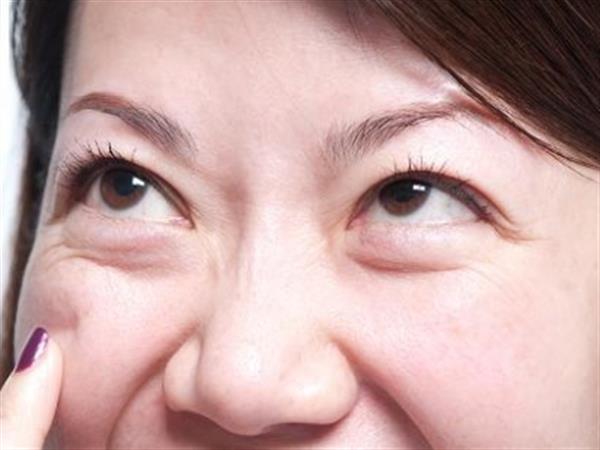 热熔<a href=http://www.mx185.com/listinfo-708-0.html target=_blank class=infotextkey>去眼袋</a>疼吗