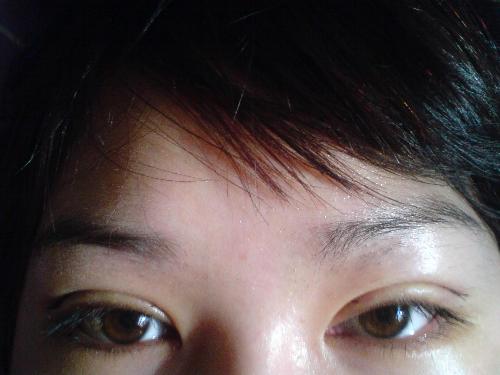割<a href=http://www.mx185.com/listinfo-724-0.html target=_blank class=infotextkey>双眼皮</a>多久自然