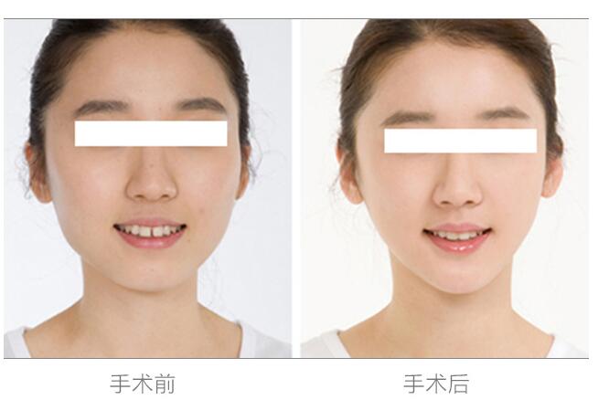 硅胶垫价格