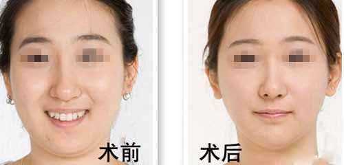 怎样减<a href=http://www.mx185.com/listinfo-638-0.html target=_blank class=infotextkey>去双下巴</a>