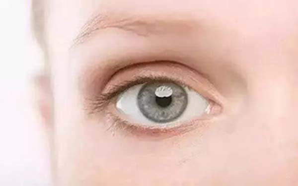 开眼角手术恢复期多久