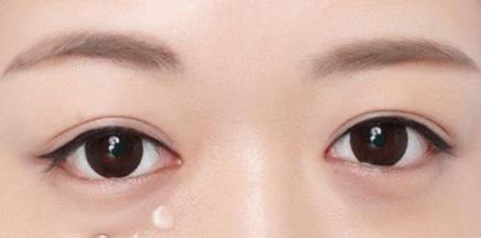 抽脂<a href=http://www.mx185.com/listinfo-708-0.html target=_blank class=infotextkey>去眼袋</a>多少钱
