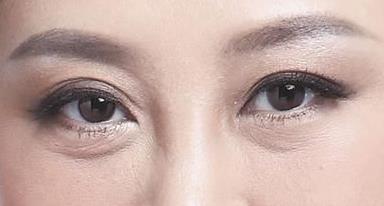 涂什么可以<a href=http://www.mx185.com/listinfo-708-0.html target=_blank class=infotextkey>去眼袋</a>