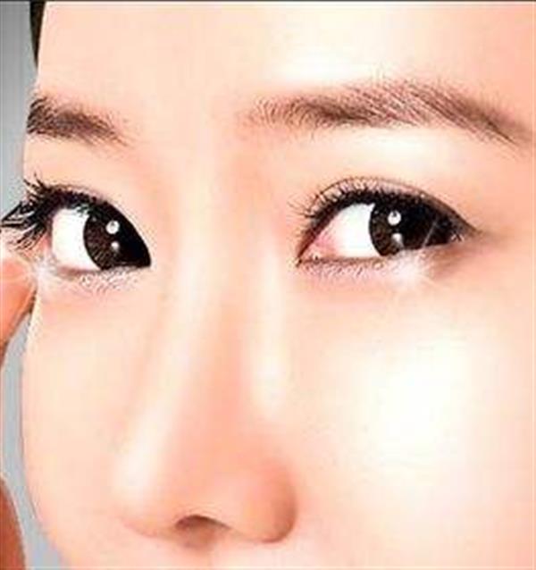 摩皱<a href=http://www.mx185.com/listinfo-708-0.html target=_blank class=infotextkey>去眼袋</a>效果好吗