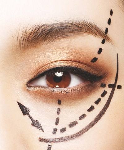 割<a href=http://www.mx185.com/listinfo-724-0.html target=_blank class=infotextkey>双眼皮</a>会引起脸肿吗
