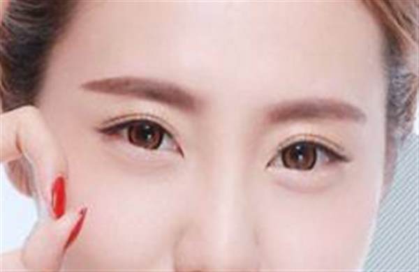 怎么分辨<a href=http://www.mx185.com/listinfo-724-0.html target=_blank class=infotextkey>双眼皮</a>