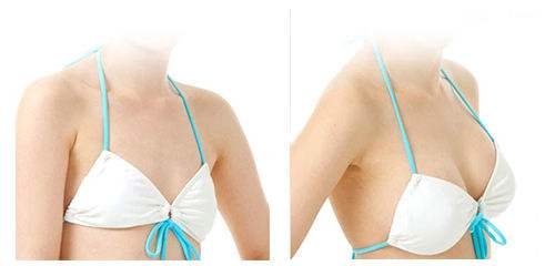 假体<a href=http://www.mx185.com/listinfo-618-0.html target=_blank class=infotextkey>隆胸</a>后可以哺乳吗