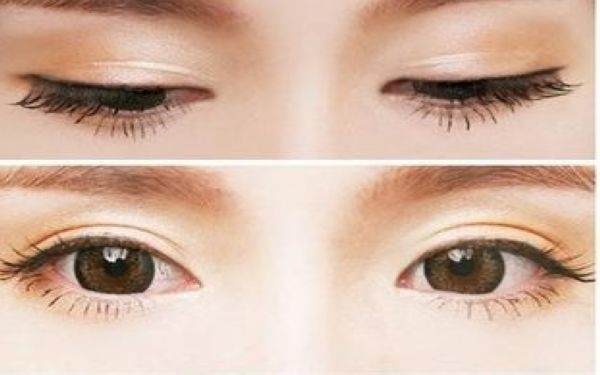 韩美切<a href=http://www.mx185.com/listinfo-724-0.html target=_blank class=infotextkey>双眼皮</a>多少钱