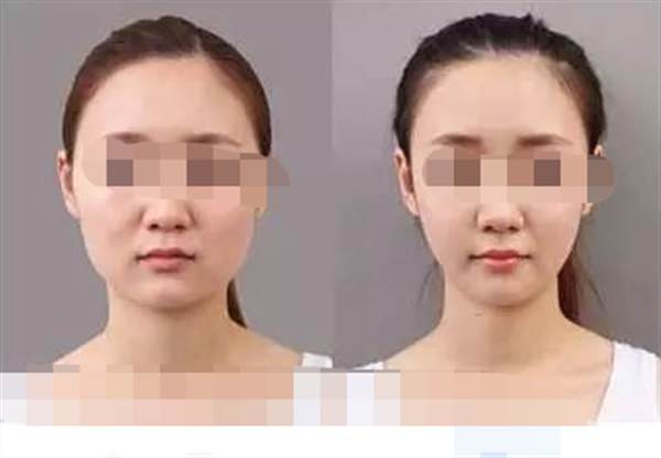 学生有效的<a href=http://www.mx185.com/listinfo-631-0.html target=_blank class=infotextkey>瘦脸</a>方法